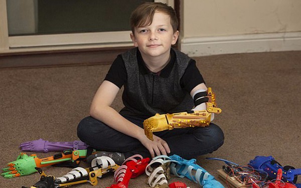 感動(dòng)！英父親為無臂兒子3D打印9只個(gè)性仿生臂