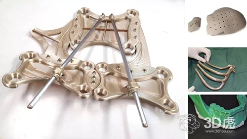 【探討】FDM 3D打印到底有沒有應(yīng)用性？(圖2)