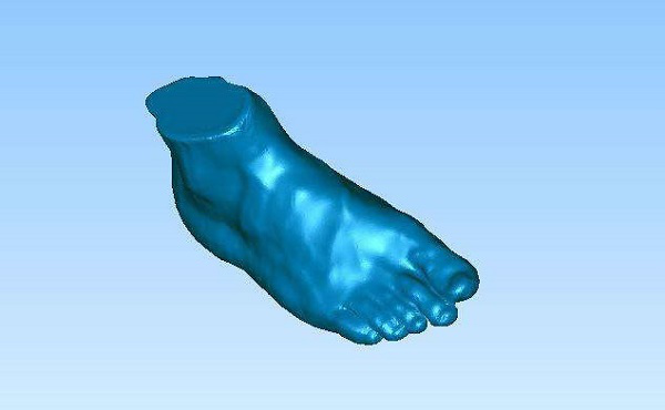 醫(yī)療3D打印機定制矯正器(圖4)